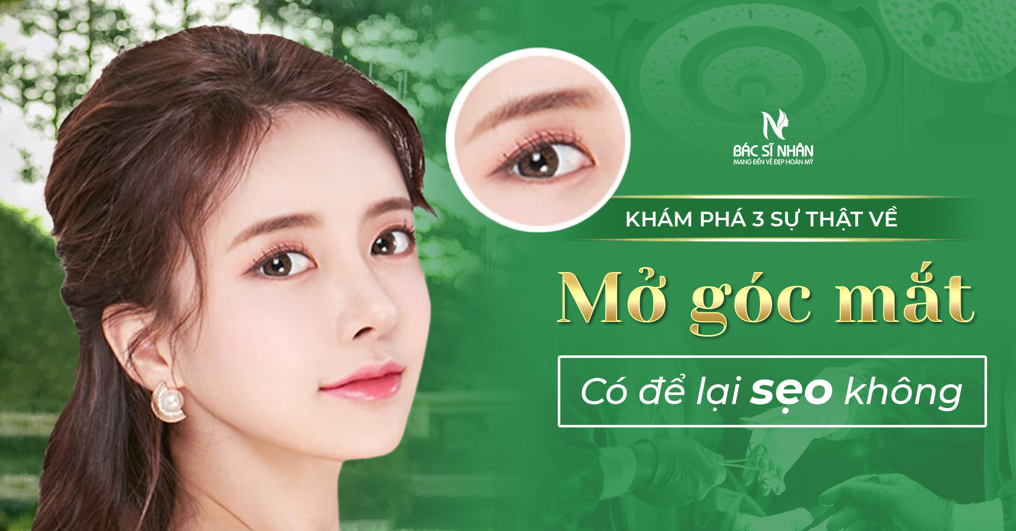 mở góc mắt