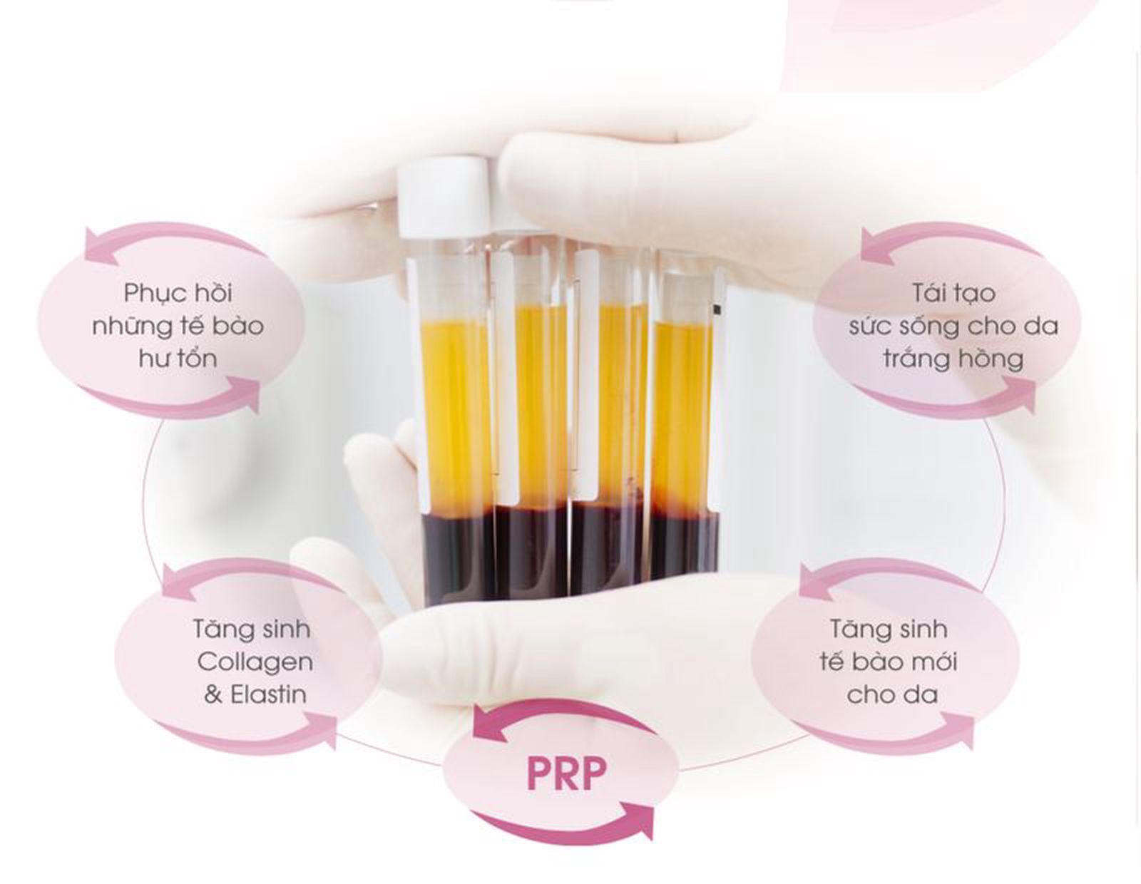 Cấy PRP giúp trẻ hóa da mặt