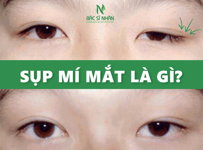 SỤP MÍ MẮT LÀ GÌ? NGUYÊN NHÂN VÀ CÁCH KHẮC PHỤC