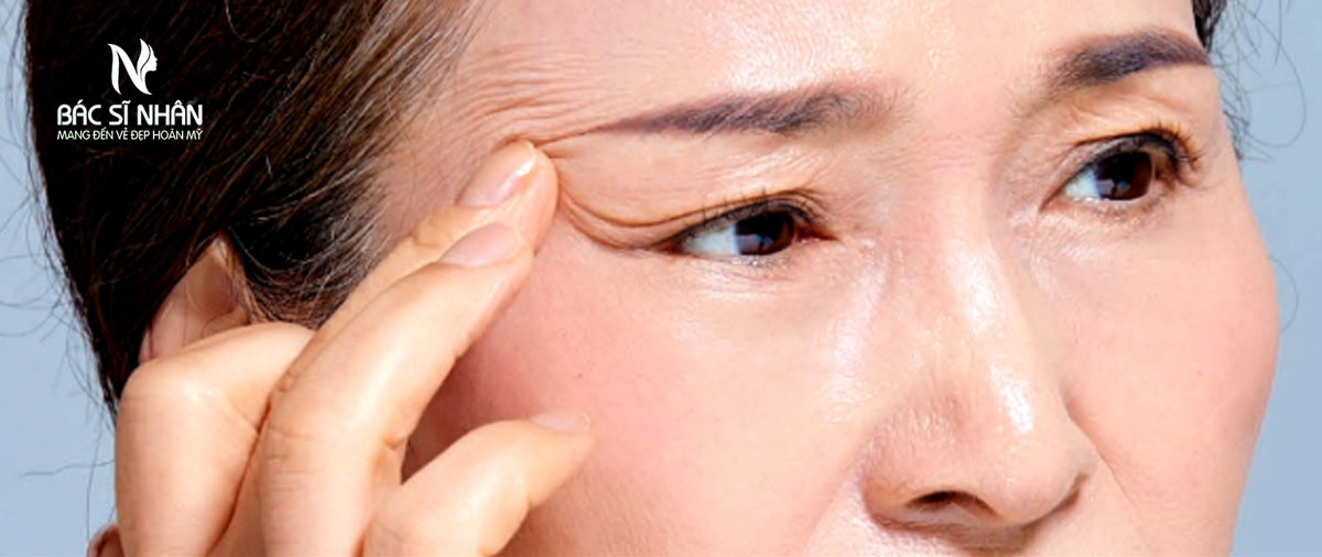 SỤP MÍ MẮT LÀ GÌ?NGUYÊN NHÂN VÀ CÁCH ĐIỀU TRỊ