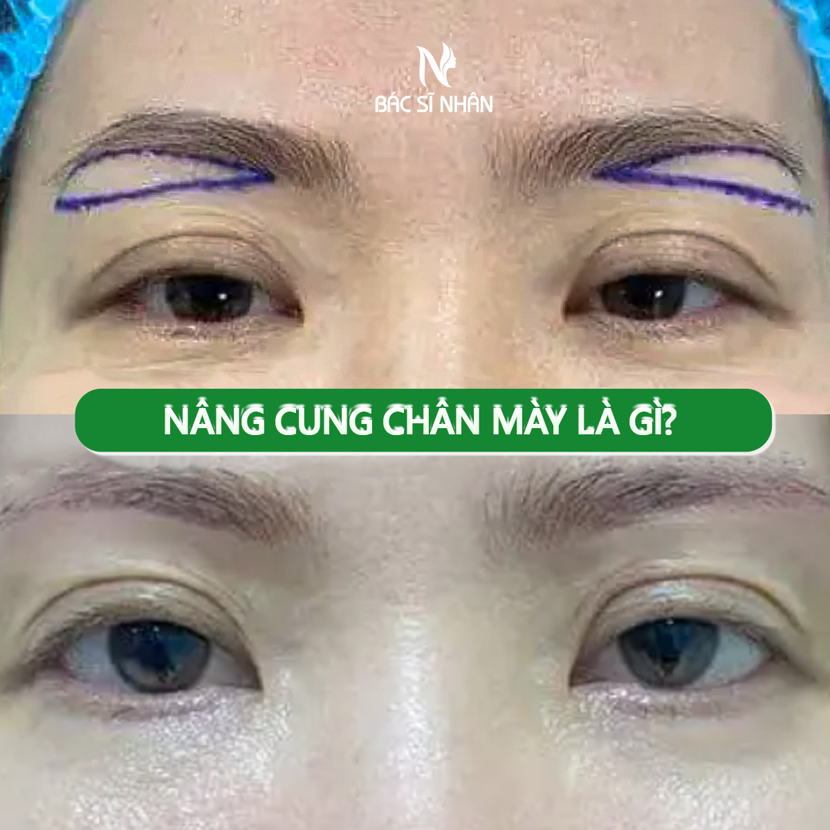 NÂNG CUNG CHÂN MÀY LÀ GÌ? ƯU VÀ NHƯỢC ĐIỂM