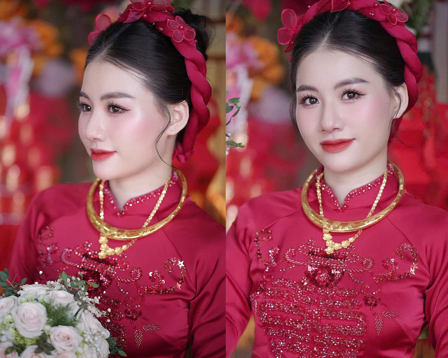 nang mui co bi keo mat khong 01