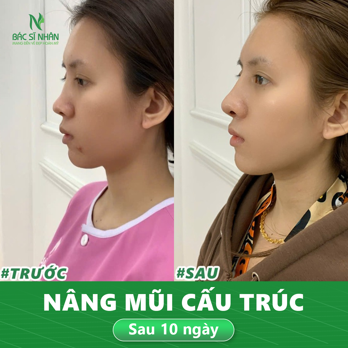 thoi-gian-gom-dau-mui-sau-nang-la-bao-lau-2