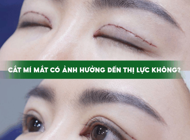 CẮT MÍ MẮT CÓ ẢNH HƯỞNG ĐẾN THỊ LỰC KHÔNG