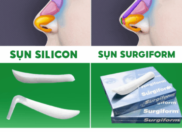 So sánh sụn Surgiform và sụn Silicon