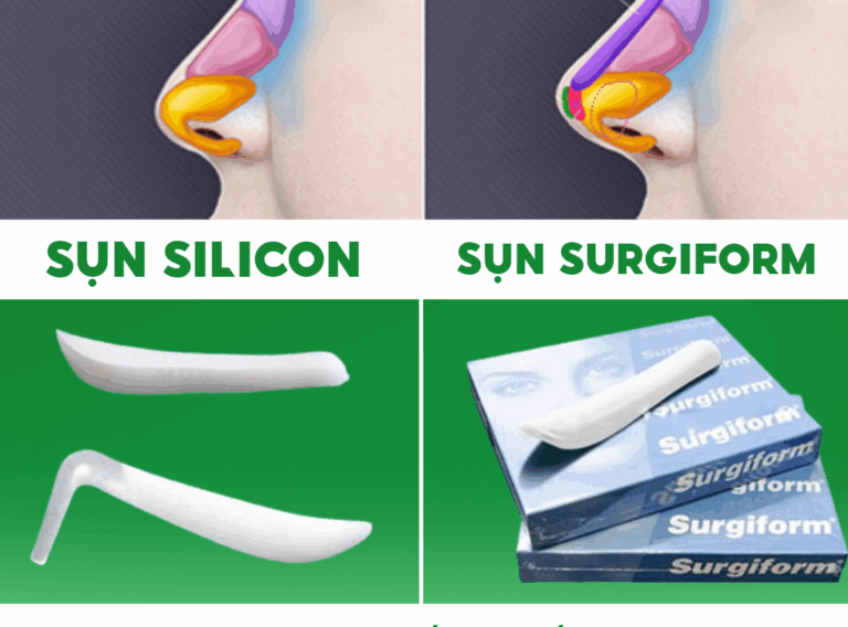 So sánh sụn Surgiform và sụn Silicon