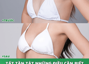 tat-tan-tat-nhung-dieu-can-biet-khi-nang-nguc-1