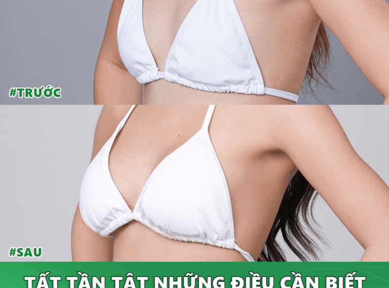 tat-tan-tat-nhung-dieu-can-biet-khi-nang-nguc-1