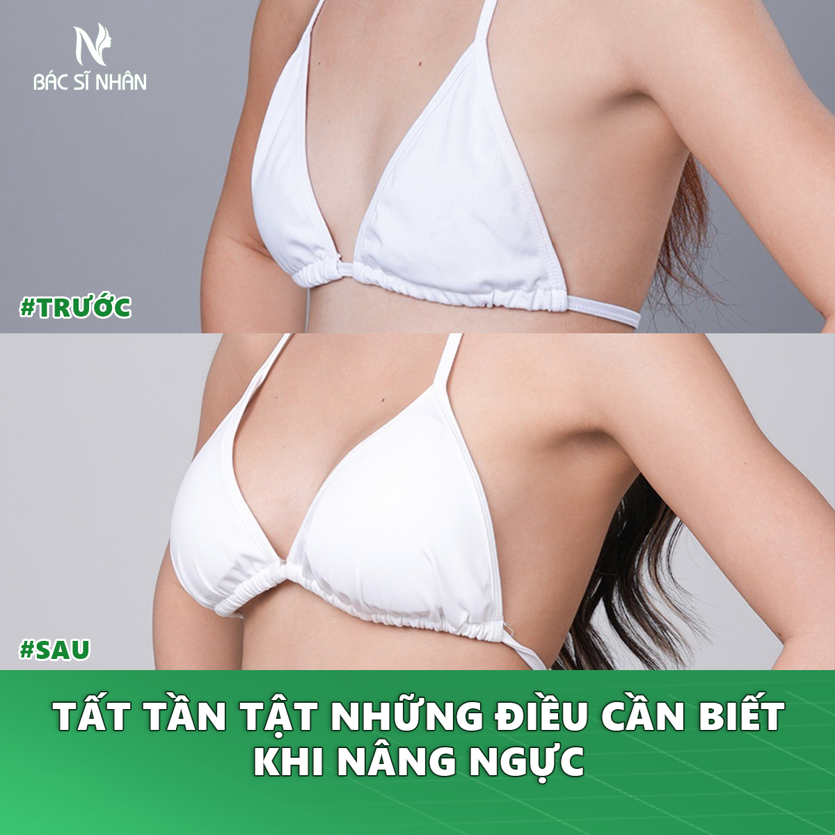tat tan tat nhung dieu can biet khi nang nguc 1