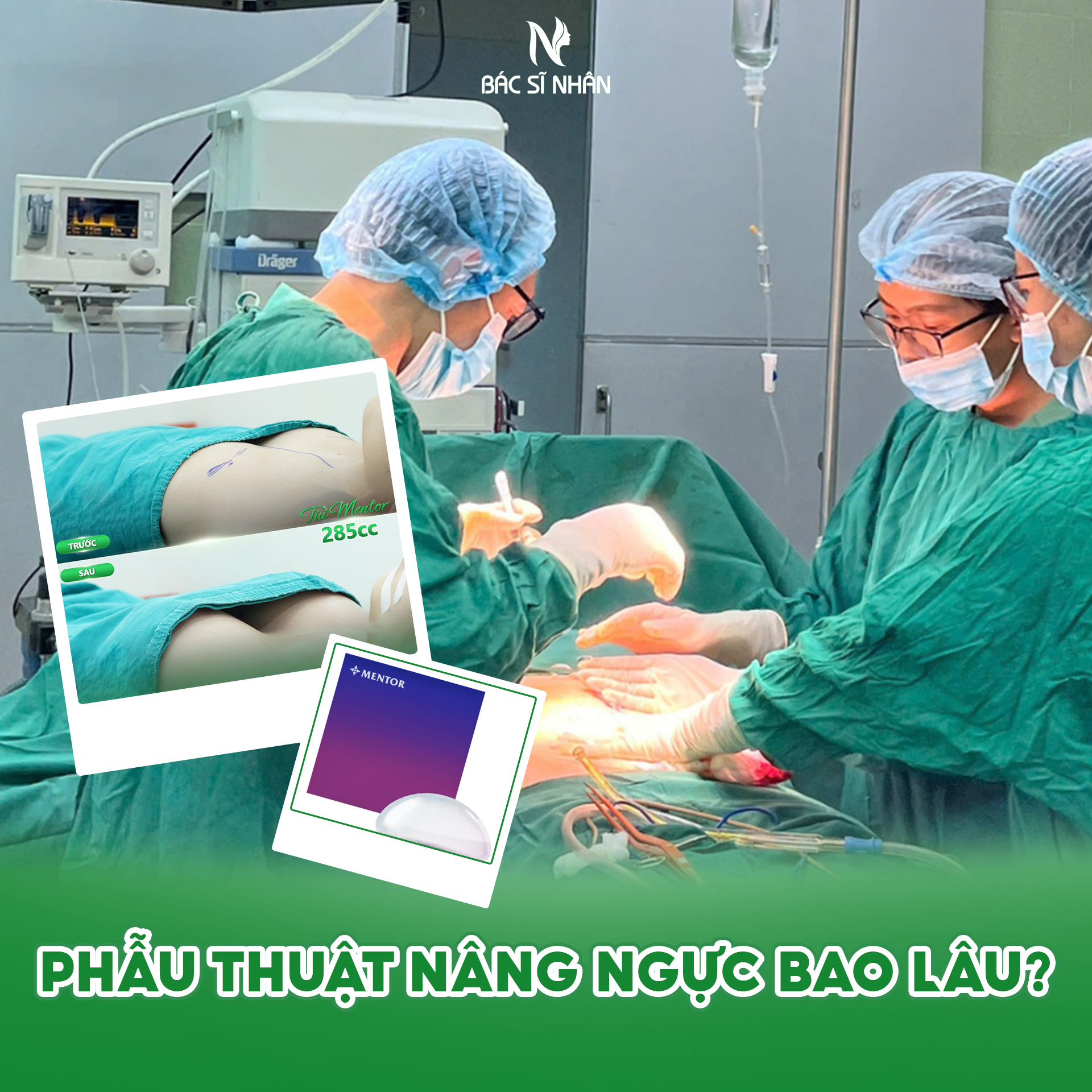 PHẪU THUẬT NÂNG NGỰC BAO LÂU