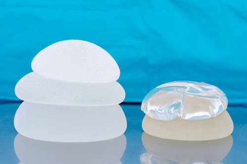 PHẪU THUẬT NÂNG NGỰC BAO LÂU