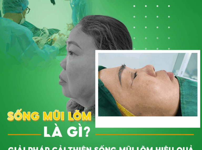 SỐNG MŨI LÕM LÀ GÌ? GIẢI PHÁP CẢI THIỆN SÓNG MŨI LÕM HIỆU QUẢ