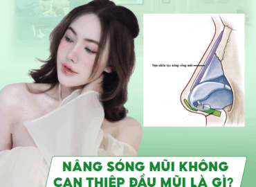 NÂNG SÓNG MŨI KHÔNG CAN THIỆP ĐẦU MŨI LÀ GÌ?