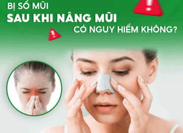 SỔ MŨI SAU KHI NÂNG MŨI CÓ NGUY HIỂM KHÔNG?