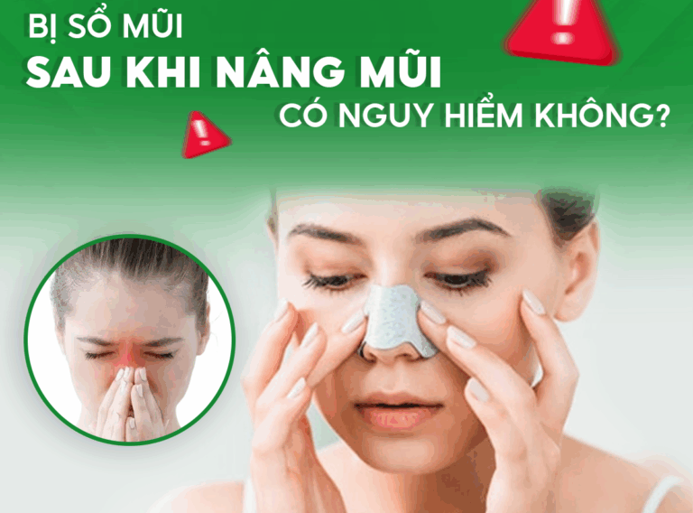SỔ MŨI SAU KHI NÂNG MŨI CÓ NGUY HIỂM KHÔNG?