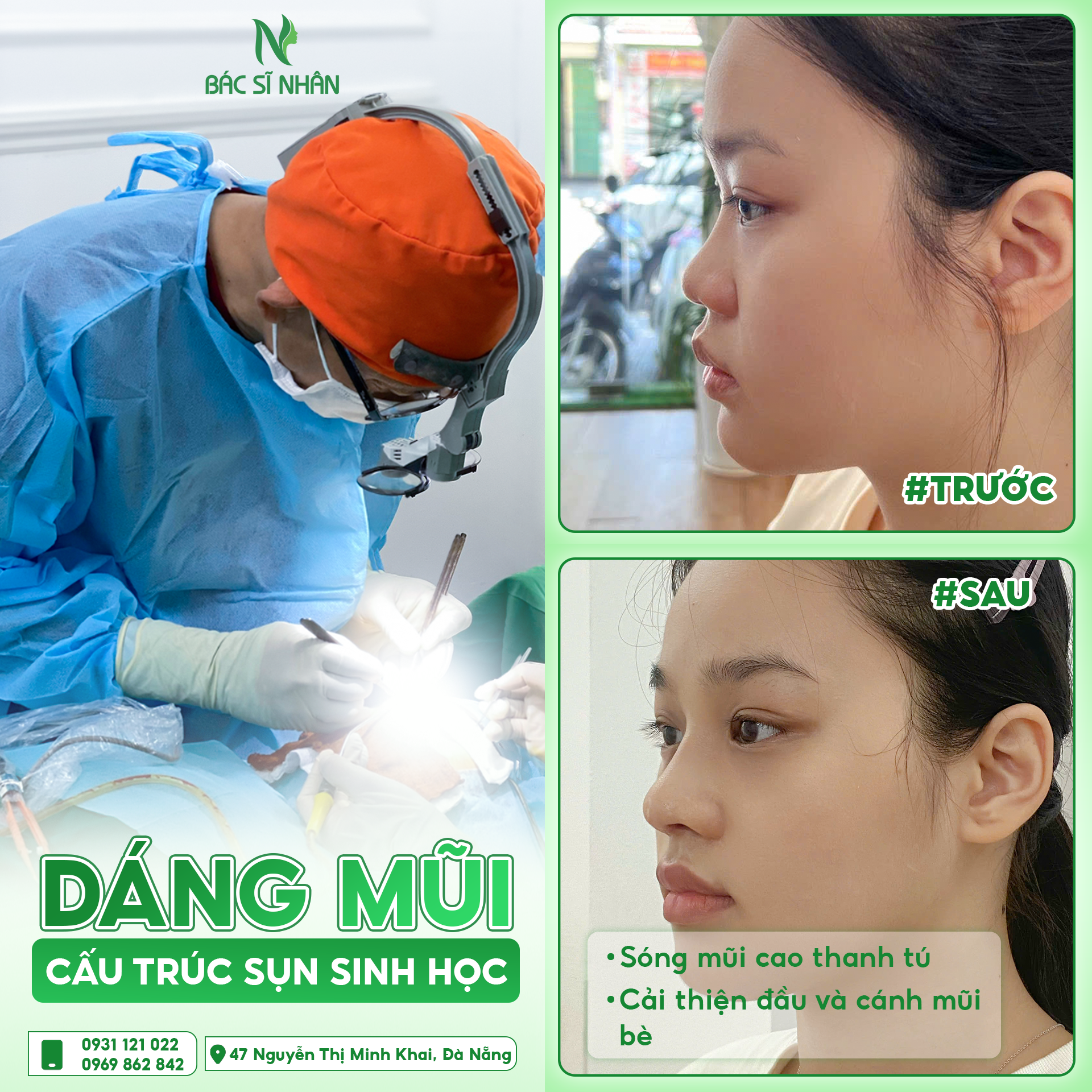 feedback mui 15.7