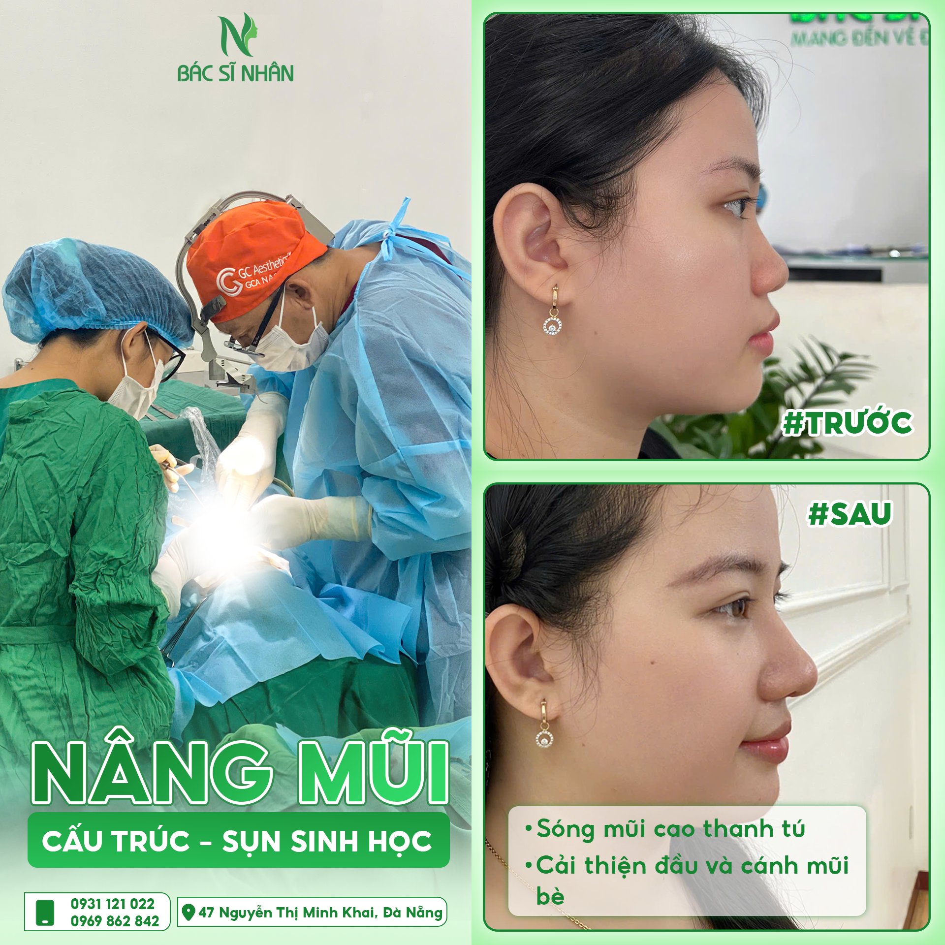 feedback mui quynh