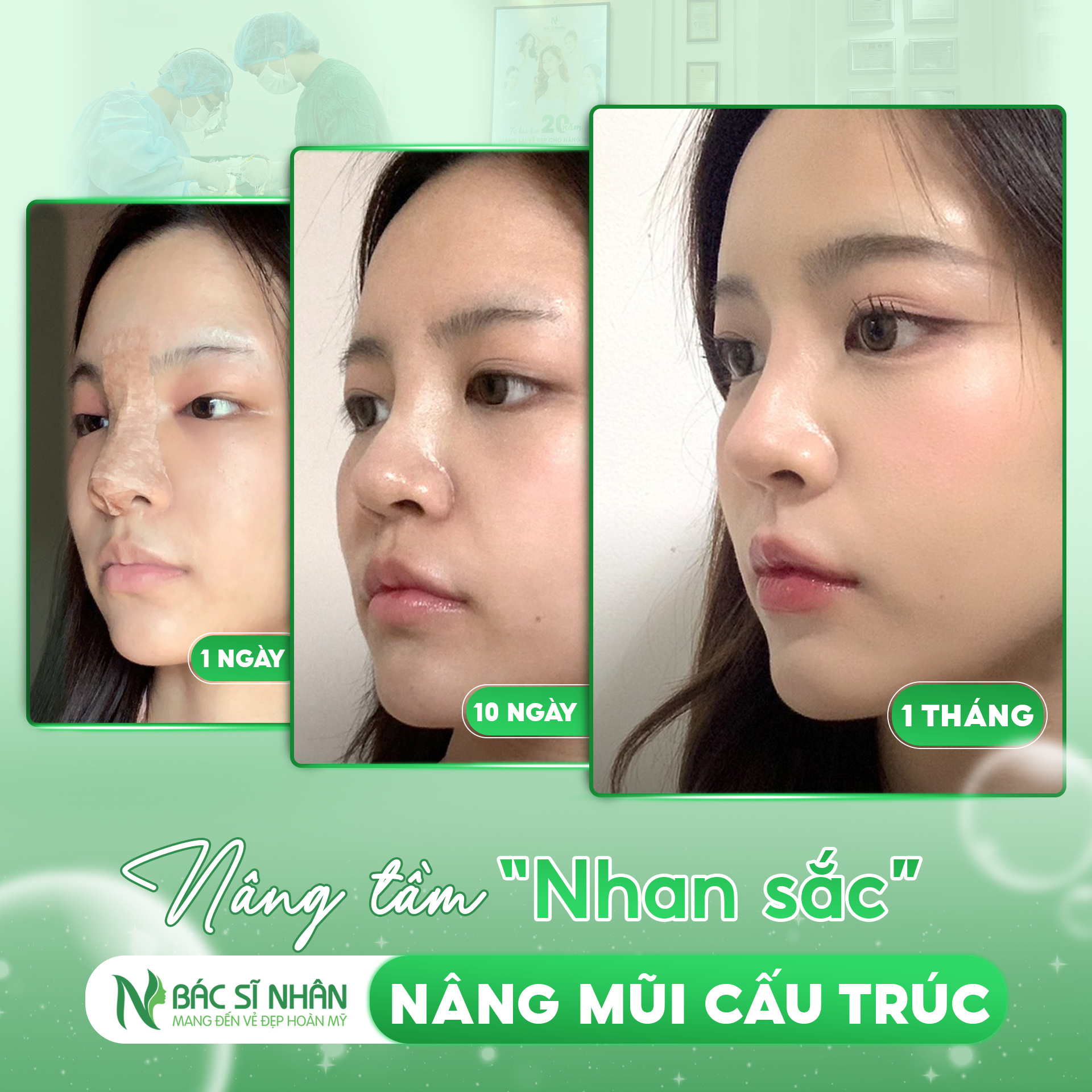 NÂNG MŨI CẤU TRÚC TẠI ĐÀ NẴNG