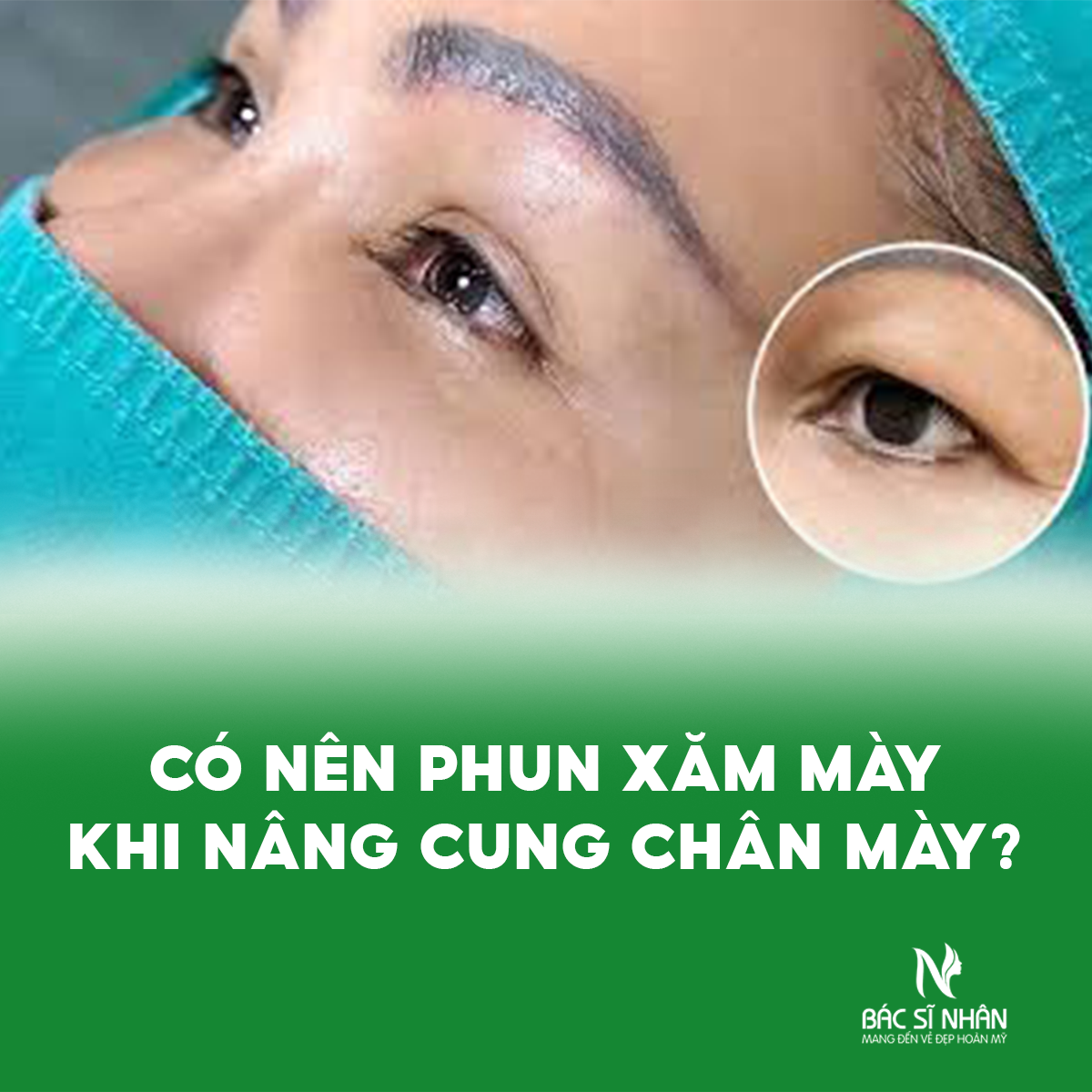 CÓ NÊN PHUN XĂM MÀY TRƯỚC KHI NÂNG CUNG CHÂN MÀY