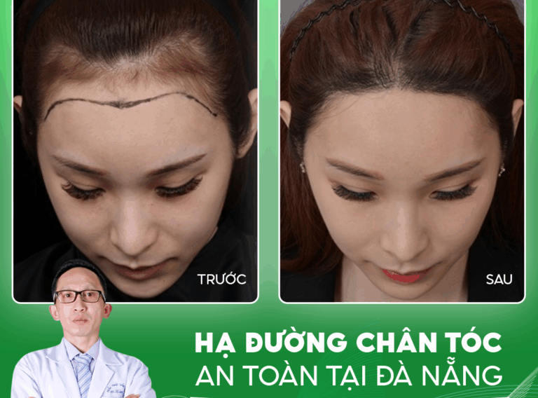 HẠ ĐƯỜNG CHÂN TÓC AN TOÀN TẠI ĐÀ NẴNG