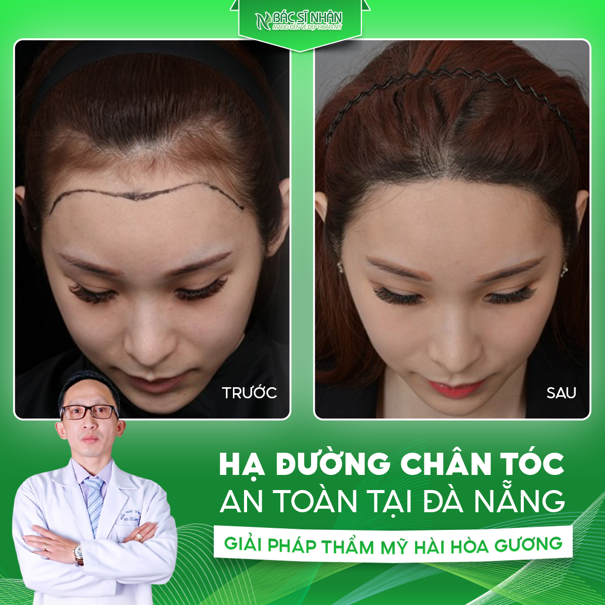 HẠ ĐƯỜNG CHÂN TÓC AN TOÀN TẠI ĐÀ NẴNG