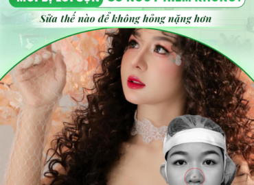 MŨI BỊ LÒI SỤN - CÓ NGUY HIỂM KHÔNG?